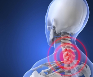 Artrosi Cervicale: sintomi e rimedi per il dolore al collo - Clinica dello  Sport®